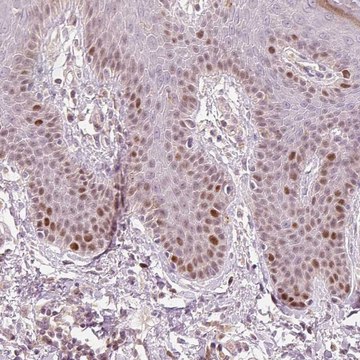 Anti-TREX2 antibody produced in rabbit Prestige Antibodies&#174; Powered by Atlas Antibodies, affinity isolated antibody, buffered aqueous glycerol solution