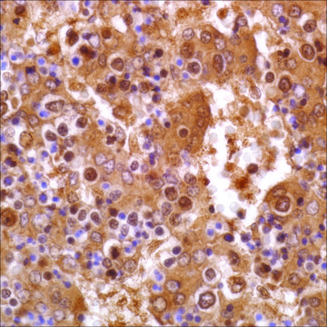 Alpha-Fetoprotein (EP209) Rabbit Monoclonal Primary Antibody