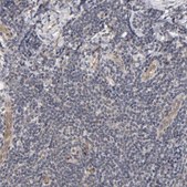 Anti-LAMB1 antibody produced in rabbit Prestige Antibodies&#174; Powered by Atlas Antibodies, affinity isolated antibody, buffered aqueous glycerol solution