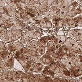 Anti-FHL1 antibody produced in rabbit Prestige Antibodies&#174; Powered by Atlas Antibodies, affinity isolated antibody, buffered aqueous glycerol solution, Ab1