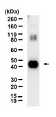 Anti-TGF &#946; receptor 1 Antibody, clone 4H18 ZooMAb&#174; Rabbit Monoclonal recombinant, expressed in HEK 293 cells