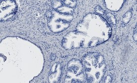 Anti-CHD-8 Antibody, clone 1H9 ZooMAb&#174; Rabbit Monoclonal recombinant, expressed in HEK 293 cells