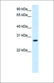 Anti-HSD11B1 antibody produced in rabbit affinity isolated antibody