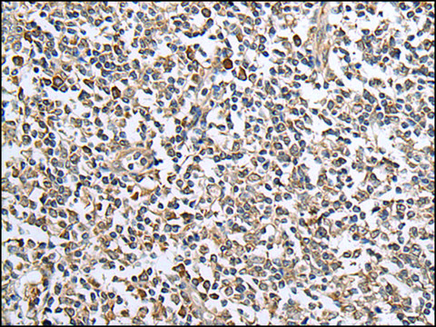 Anti-CXCL1 affinity isolated antibody