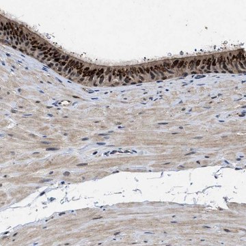 Anti-TPST2 antibody produced in rabbit Prestige Antibodies&#174; Powered by Atlas Antibodies, affinity isolated antibody, buffered aqueous glycerol solution