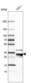 Anti-RNASET2 antibody produced in rabbit Prestige Antibodies&#174; Powered by Atlas Antibodies, affinity isolated antibody, buffered aqueous glycerol solution
