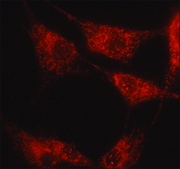 Anti-&#945;1,2-Mannosidase IA antibody produced in rabbit affinity isolated antibody, buffered aqueous solution