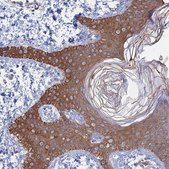Anti-IL7 antibody produced in rabbit Prestige Antibodies&#174; Powered by Atlas Antibodies, affinity isolated antibody, buffered aqueous glycerol solution