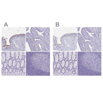 Anti-CCDC39 antibody produced in rabbit Prestige Antibodies&#174; Powered by Atlas Antibodies, affinity isolated antibody, buffered aqueous glycerol solution