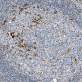 Anti-CECR1 antibody produced in rabbit Prestige Antibodies&#174; Powered by Atlas Antibodies, affinity isolated antibody, buffered aqueous glycerol solution
