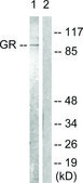 Anti-GR antibody produced in rabbit affinity isolated antibody