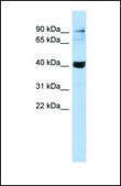 Anti-MMP3 antibody produced in rabbit affinity isolated antibody