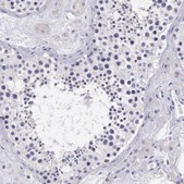 Anti-ARG2 antibody produced in rabbit affinity isolated antibody, buffered aqueous glycerol solution