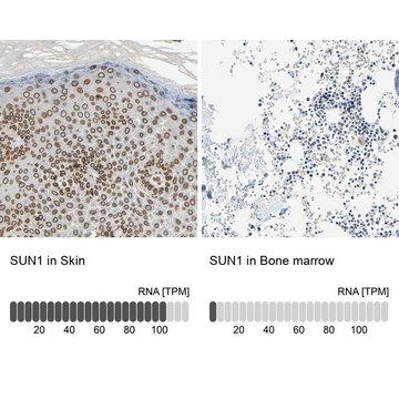 ANTI-SUN1 antibody produced in rabbit Ab1, Prestige Antibodies&#174; Powered by Atlas Antibodies, affinity isolated antibody, buffered aqueous glycerol solution