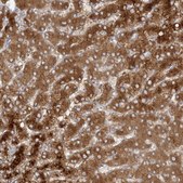 Anti-ALDH1L1 antibody produced in rabbit Prestige Antibodies&#174; Powered by Atlas Antibodies, affinity isolated antibody, buffered aqueous glycerol solution