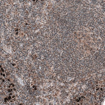 Anti-ZCCHC7 antibody produced in rabbit Prestige Antibodies&#174; Powered by Atlas Antibodies, affinity isolated antibody, buffered aqueous glycerol solution