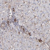 Anti-ACTN4 antibody produced in rabbit Prestige Antibodies&#174; Powered by Atlas Antibodies, affinity isolated antibody, buffered aqueous glycerol solution