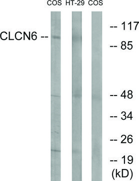 Anti-CLCN6 antibody produced in rabbit affinity isolated antibody