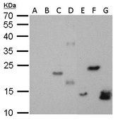 Monoclonal Anti-6X His tag antibody produced in mouse clone GT359, affinity isolated antibody