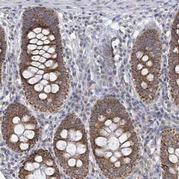 Anti-COQ10B antibody produced in rabbit Prestige Antibodies&#174; Powered by Atlas Antibodies, affinity isolated antibody, buffered aqueous glycerol solution