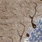 Anti-RET antibody produced in rabbit Prestige Antibodies&#174; Powered by Atlas Antibodies, affinity isolated antibody, buffered aqueous glycerol solution