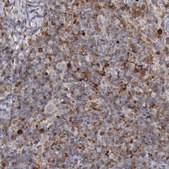 Anti-STAT1 antibody produced in rabbit Ab2, Prestige Antibodies&#174; Powered by Atlas Antibodies, affinity isolated antibody, buffered aqueous glycerol solution