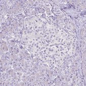 Anti-CYP17A1 antibody produced in rabbit Prestige Antibodies&#174; Powered by Atlas Antibodies, affinity isolated antibody, buffered aqueous glycerol solution