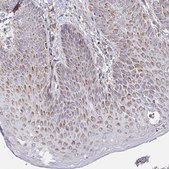 Anti-MAVS antibody produced in rabbit Prestige Antibodies&#174; Powered by Atlas Antibodies, affinity isolated antibody, buffered aqueous glycerol solution