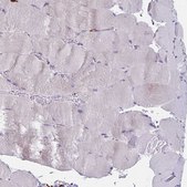 Anti-CD163 antibody produced in rabbit Prestige Antibodies&#174; Powered by Atlas Antibodies, affinity isolated antibody, buffered aqueous glycerol solution