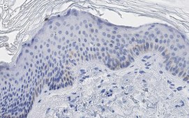 Anti-Cytokeratin-14 Antibody, clone 1D15 ZooMAb&#174; Rabbit Monoclonal recombinant, expressed in HEK 293 cells