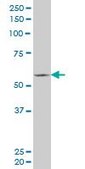Monoclonal Anti-FLI1 antibody produced in mouse clone 2G8, purified immunoglobulin, buffered aqueous solution