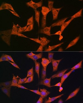 Anti-USP10 antibody produced in rabbit