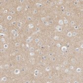 Anti-MPRIP antibody produced in rabbit Prestige Antibodies&#174; Powered by Atlas Antibodies, affinity isolated antibody, buffered aqueous glycerol solution, Ab1
