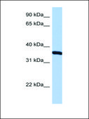 Anti-RPLP0 (AB1) antibody produced in rabbit affinity isolated antibody