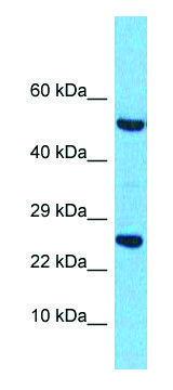 Anti-RRAS2 (C-terminal) antibody produced in rabbit affinity isolated antibody