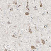 Anti-GRN antibody produced in rabbit Prestige Antibodies&#174; Powered by Atlas Antibodies, affinity isolated antibody, buffered aqueous glycerol solution