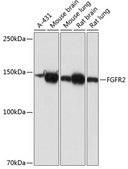 [KO Validated]Anti-FGFR2 Antibody, clone 0O6A9, Rabbit Monoclonal