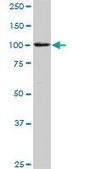 Anti-TNNI3K antibody produced in rabbit purified immunoglobulin, buffered aqueous solution