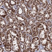 Anti-ACAD9 antibody produced in rabbit Prestige Antibodies&#174; Powered by Atlas Antibodies, affinity isolated antibody, buffered aqueous glycerol solution