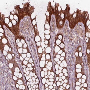 Anti-CHMP3 antibody produced in rabbit Prestige Antibodies&#174; Powered by Atlas Antibodies, affinity isolated antibody