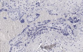 Anti-Angiopoietin-2 Antibody, clone 4L18 ZooMAb&#174; Rabbit Monoclonal recombinant, expressed in HEK 293 cells
