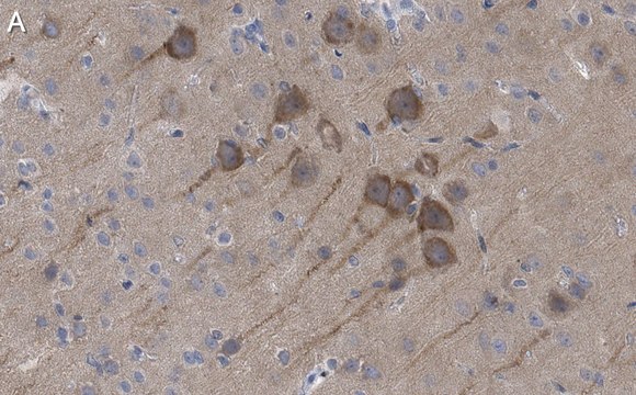 Anti-NMDAR2B Antibody, clone 5C18 ZooMAb&#174; Rabbit Monoclonal recombinant, expressed in HEK 293 cells