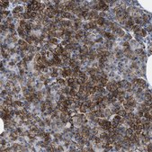 Anti-KCNJ5 antibody produced in rabbit Prestige Antibodies&#174; Powered by Atlas Antibodies, affinity isolated antibody, buffered aqueous glycerol solution