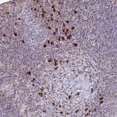Anti-IL18BP antibody produced in rabbit Prestige Antibodies&#174; Powered by Atlas Antibodies, affinity isolated antibody, buffered aqueous glycerol solution