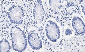 Anti-ZNF638 Antibody, clone 4C19 ZooMAb&#174; Rabbit Monoclonal recombinant, expressed in HEK 293 cells