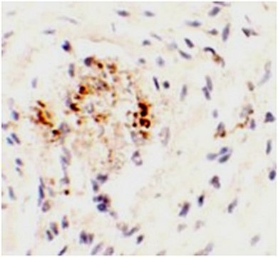 Anti-LEMD3 Antibody from rabbit, purified by affinity chromatography