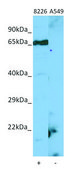 Anti-LBR antibody produced in rabbit affinity isolated antibody