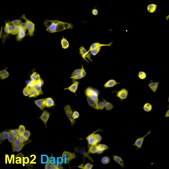 N2A Psen1/Psen2 Double Knockout Mouse Neuroblastoma Cell Line