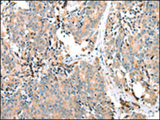 Anti-EPHA2 affinity isolated antibody