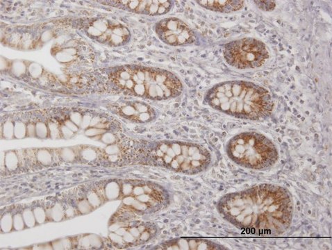 Anti-TFAM antibody produced in mouse purified immunoglobulin, buffered aqueous solution